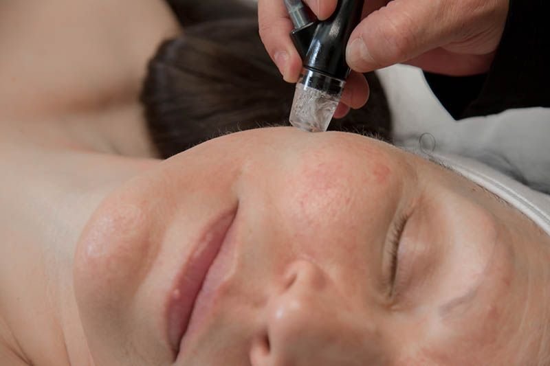 Tratamiento Facial SilkPeel en Saudé Spa Tijuana