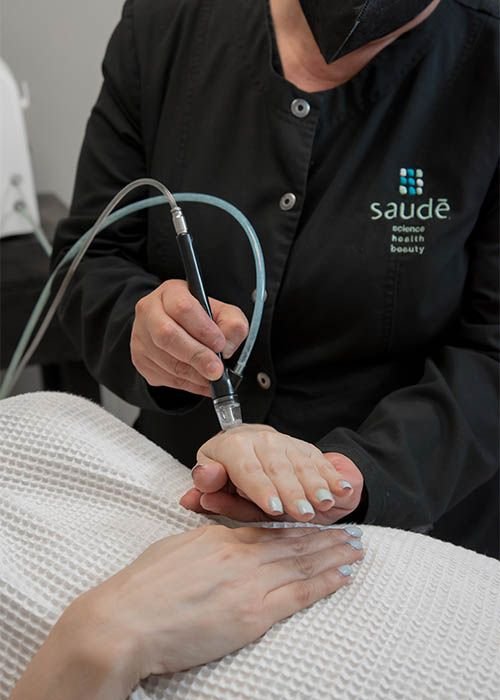 Tratamiento SilkPeel en manos en Saudé Spa Tijuana